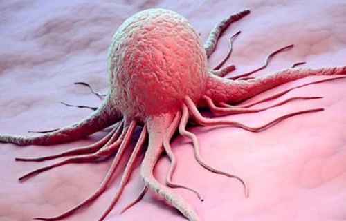 ژن‌های مقاوم به درمان سرطان کشف شدند