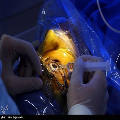 جراحی رایگان چشم 150 بیمار کم‌بضاعت به همت سپاه در سنندج